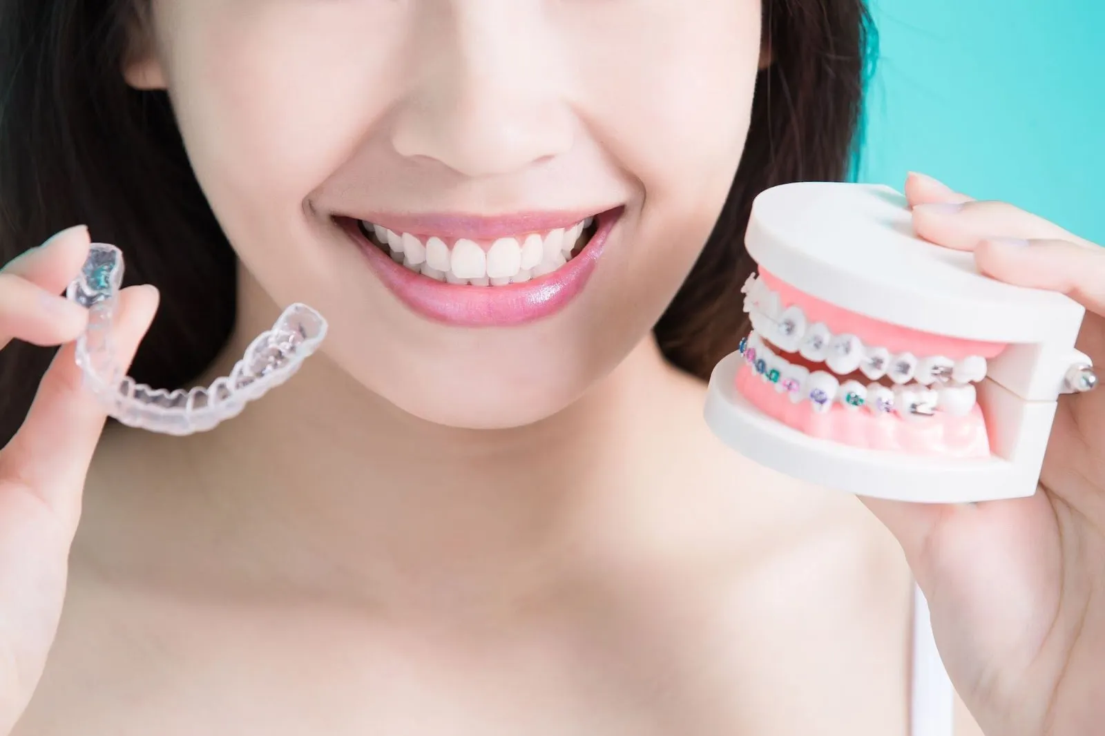 The Braces Battle