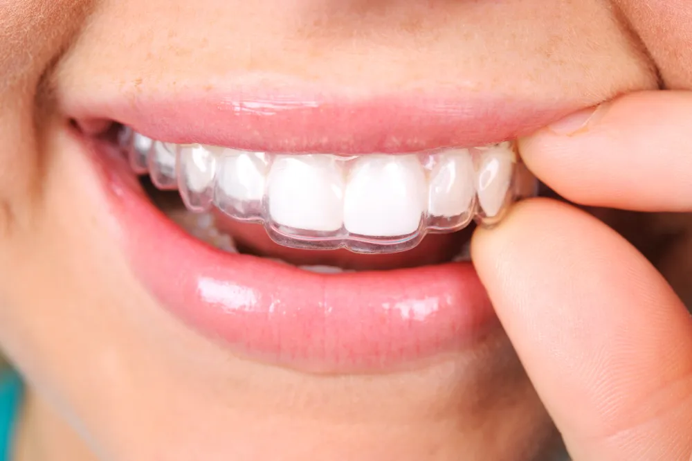 Retainer Check and Post-Treatment Visits