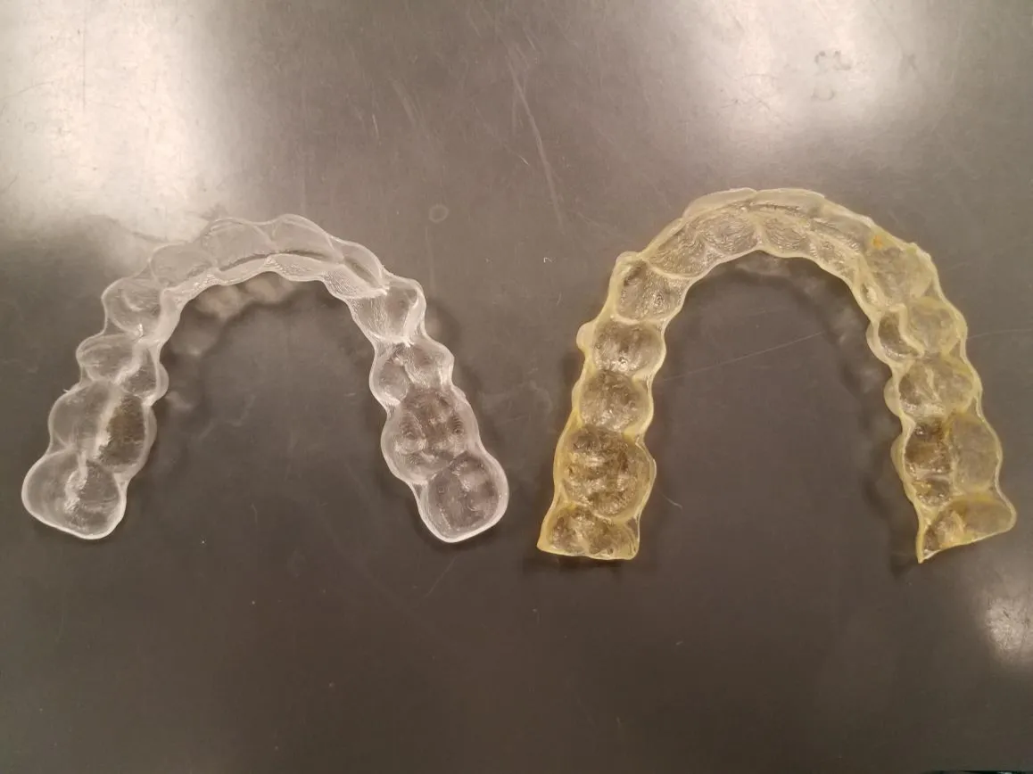 Why You Shouldn’t Vape with Invisalign