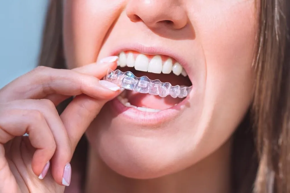 Understanding Tooth Sensitivity During Invisalign Treatment