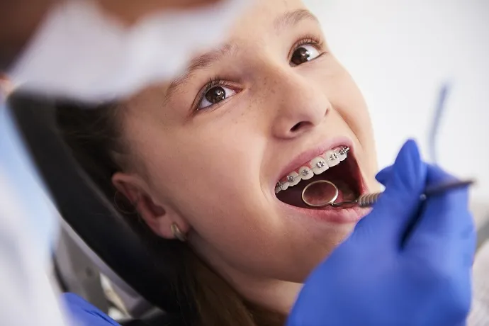8. Consulting Your Orthodontist