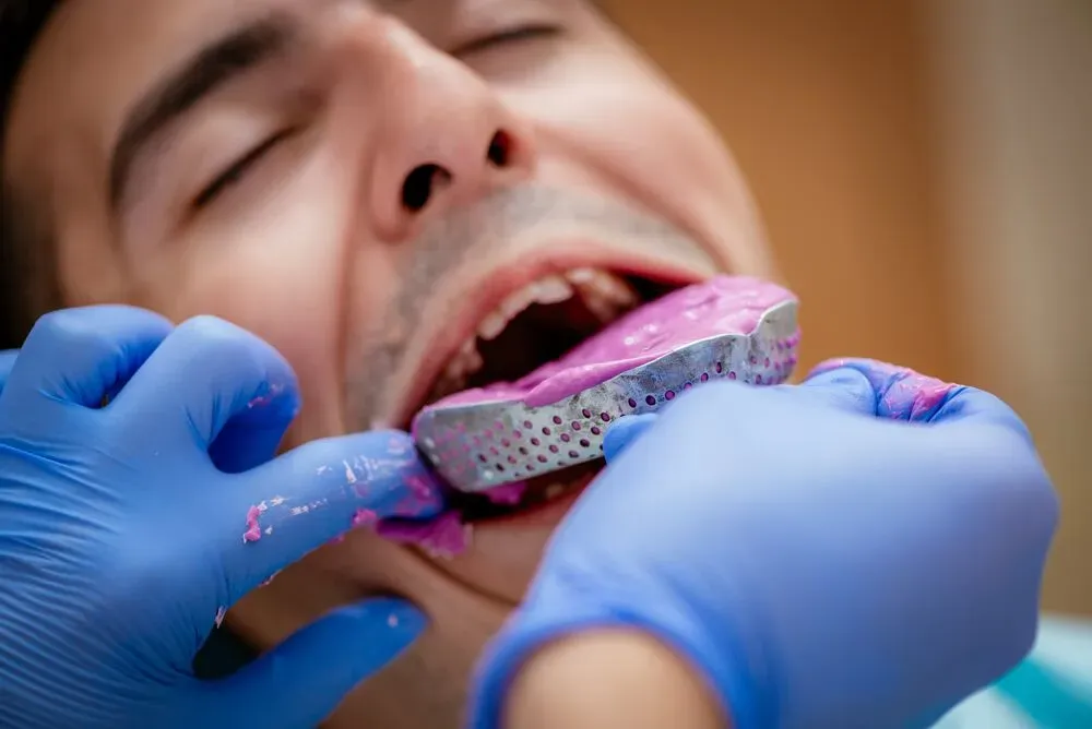 Digital vs. Physical Retainer Molds: Which Lasts Longer?